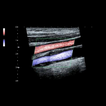 Echographie Doppler Radiologie Et Imagerie M Dicale Tzanck