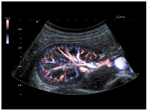 Echographie Doppler Radiologie Et Imagerie M Dicale Tzanck